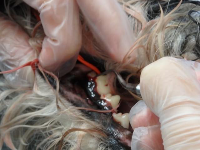 歯石（歯肉縁上・歯肉縁下）の除去