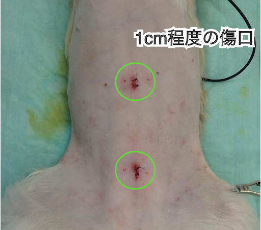 腹腔鏡の手術の傷跡