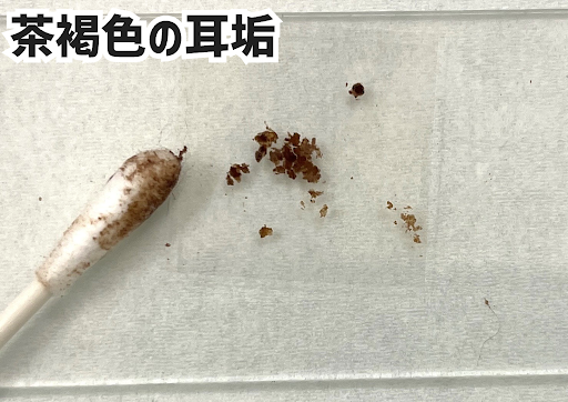 茶褐色の耳垢