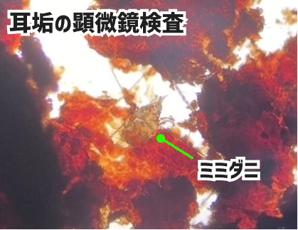 ミミダニの顕微鏡検査画像