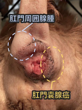 肛門周囲腺腫と肛門嚢腺癌の位置