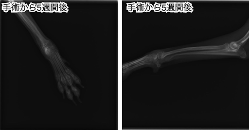 ピン抜去後の橈尺骨骨折のレントゲン画像