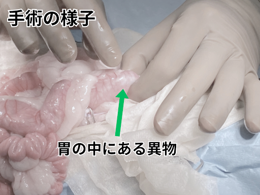 胃の中に異物がある手術の様子