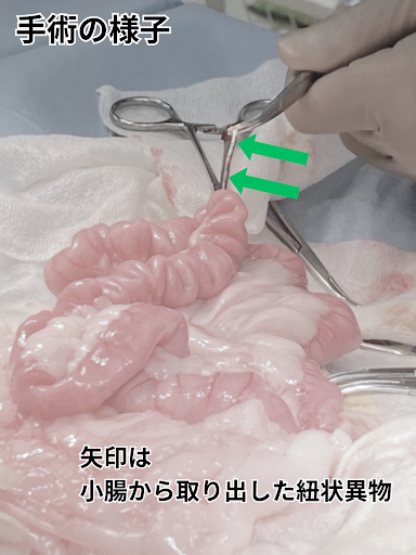 小腸から紐状の異物を取り出している様子