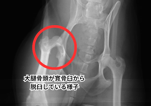 大腿骨頭が寛骨臼から脱臼している様子