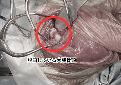 脱臼している大腿骨頭