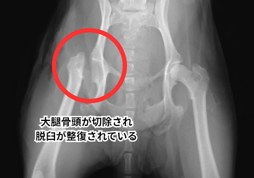大腿骨頭が切断され脱臼が整復されいている様子