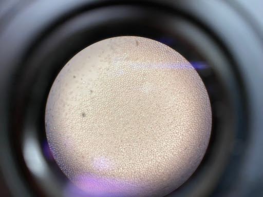 クロスマッチ試験主反応の赤血球