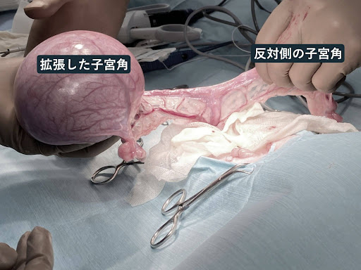 手術時に確認した拡張した子宮