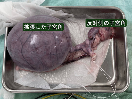 摘出した子宮