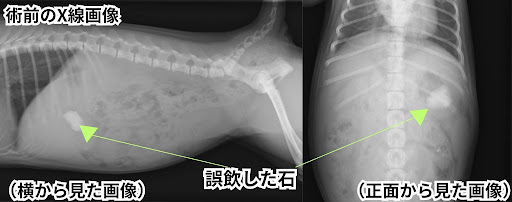 石を飲み込んだレントゲン画像