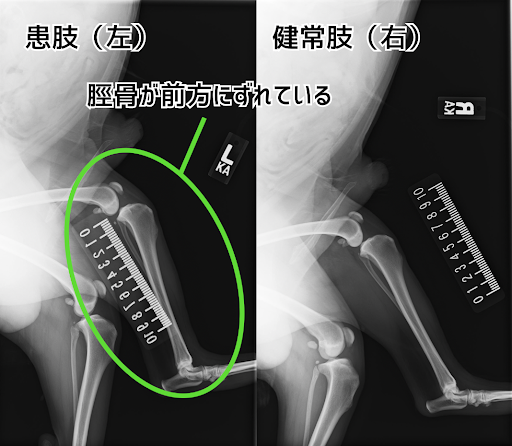 術前の患肢のレントゲン画像