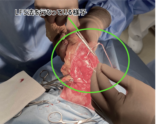 LFS法を行なっている様子