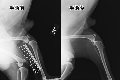 術前、術後の患肢のレントゲン画像