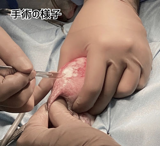 実際の手術の様子