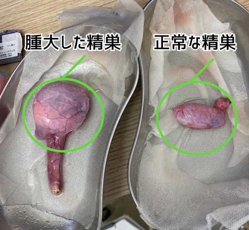 摘出された精巣腫瘍