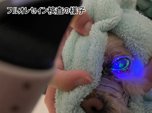 フルオレセイン検査の様子