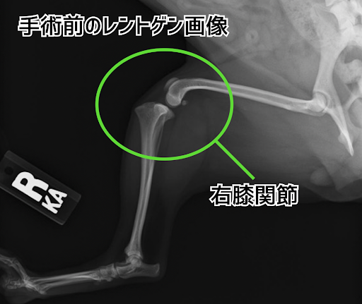 膝蓋骨脱臼の手術前のレントゲン画像