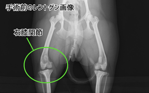 膝蓋骨脱臼の手術前のレントゲン画像