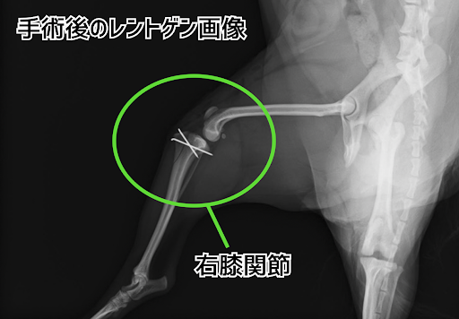 膝蓋骨脱臼の手術後のレントゲン画像