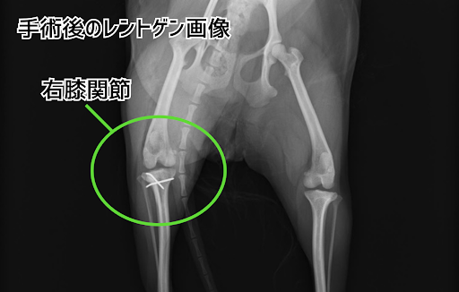 膝蓋骨脱臼の手術後のレントゲン画像