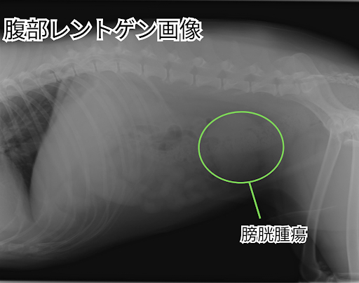 膀胱腫瘍のレントゲン画像