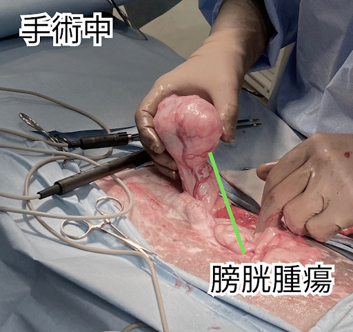 膀胱腫瘍を摘出する様子