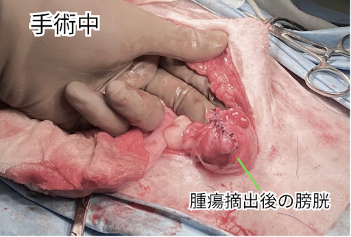 腫瘍摘出後の膀胱
