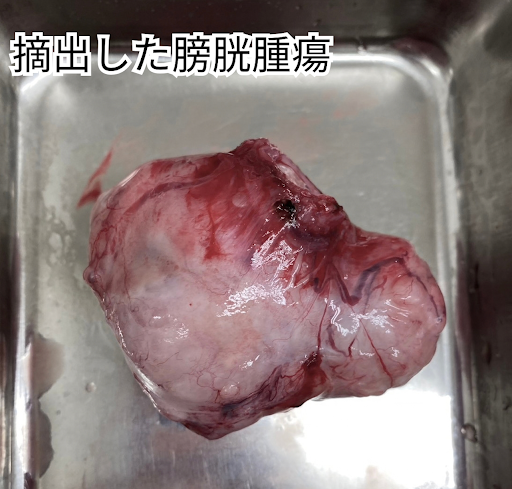 摘出した膀胱腫瘍