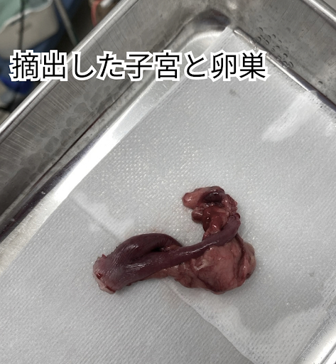 摘出した子宮と卵巣