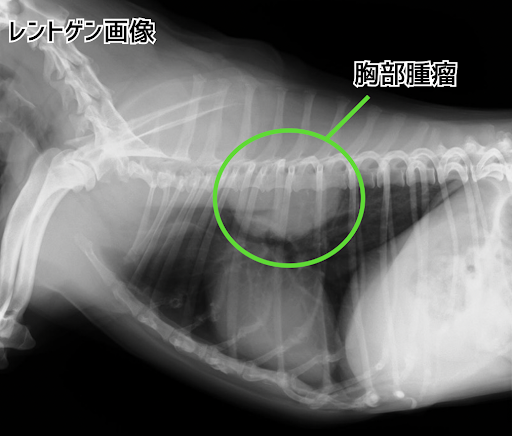 胸部腫瘤のレントゲン画像