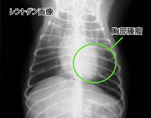 胸部腫瘤のレントゲン画像