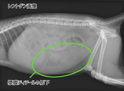 腹水が溜まっているレントゲン画像