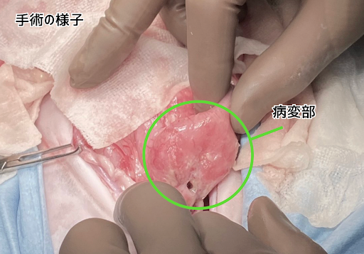 消化管穿孔の手術の様子