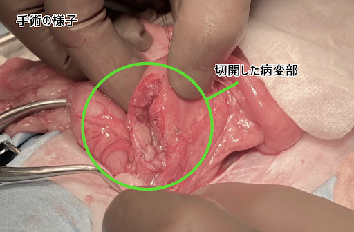 病変部の消化管を切開した様子