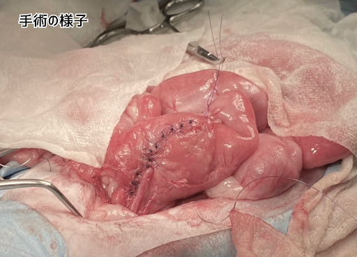 消化管穿孔後の手術が終わった様子