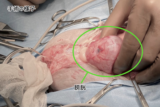膀胱・尿道全摘出術の様子