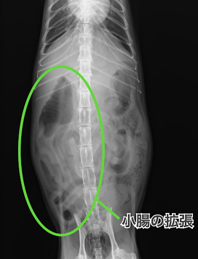 小腸が拡張しているレントゲン画像