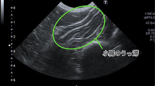 小腸が鬱滞しているエコー画像