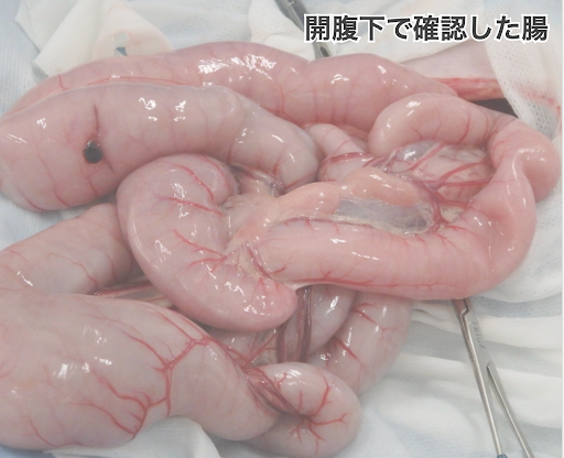 開腹下で確認した腸