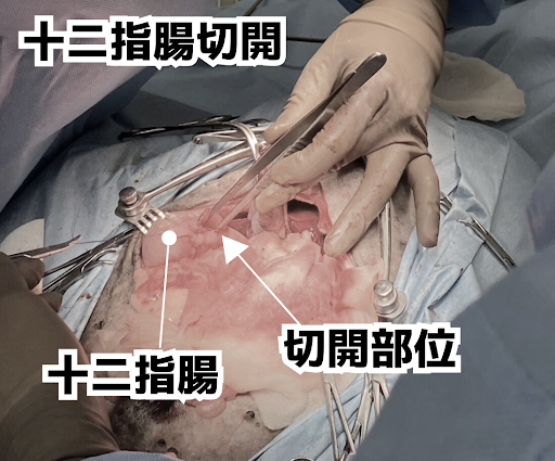 十二指腸切開の様子