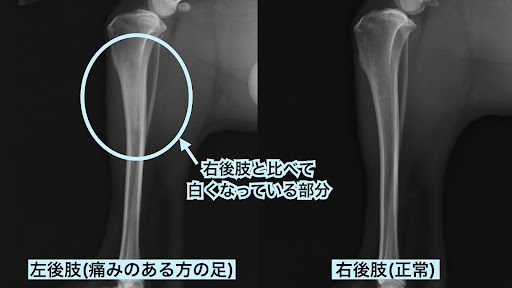 汎骨炎のレントゲン画像