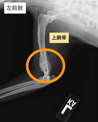 細菌性骨髄炎の上腕骨のレントゲン画像