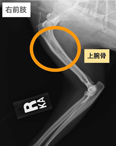 細菌性骨髄炎の上腕骨のレントゲン画像