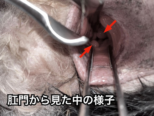 肛門から見た中の様子