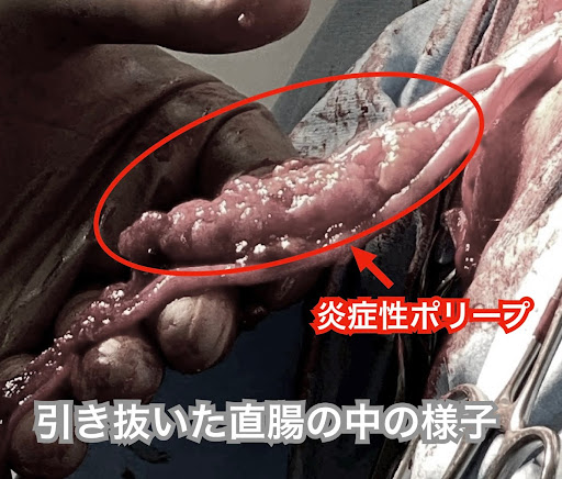 引き抜いた直腸の中の様子