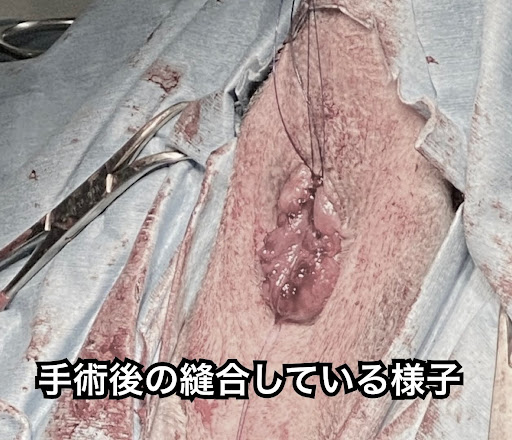 手術後の縫合している様子