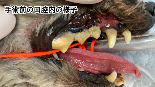 手術前の歯周病の口腔内の様子