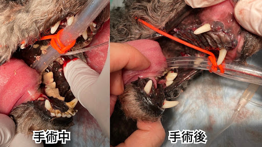 手術中、手術後の口腔内の差
