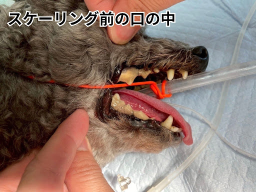 スケーリング前の口の中の様子